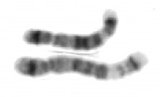 einzelnes Chromosom im Karyogramm