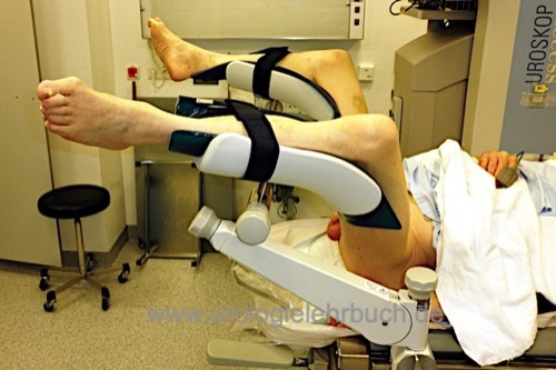 Steinschnittlagerung vor transurethraler Operation