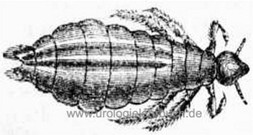 Pediculus capitis Pedikulosis Kopflaus