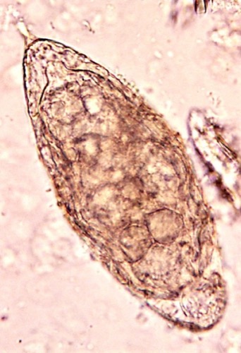 Ei von Schistosoma haematobium Bilharziose Schistosomiasis
