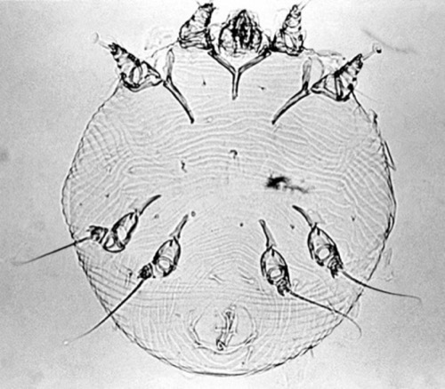 Krätzmilbe Sarcoptes scabiei var. hominis Erreger Skabies Dermatitis