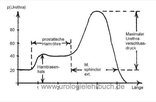 Urethradruckprofil bei Männern Urethradruckprofil bei Männern