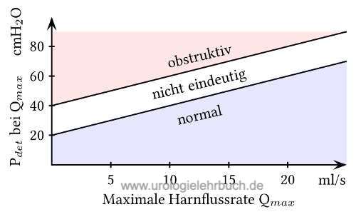 ICS Nomogramm (BOOI) zur Ermittlung einer subvesikalen Obstruktion in der Druck-Fluss-Kurve