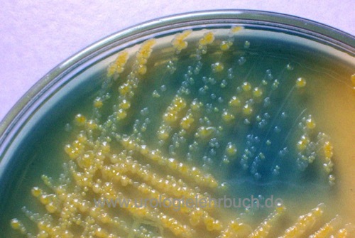 Abbildung Wachstum einer Mischkultur von laktosefermentierenden Bakterien (gelbe Kolonien) und Nonfermentern (blaue Kolonien) auf CLED-Agar