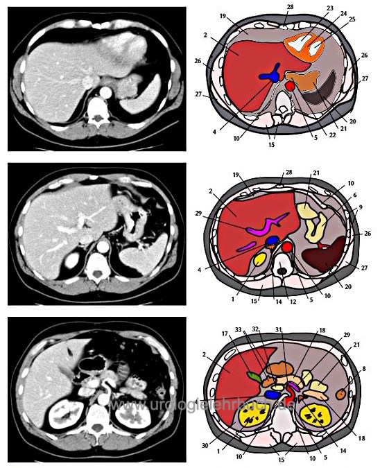 Abbildung CT Schnittbild Anatomie Abdomen Becken 1