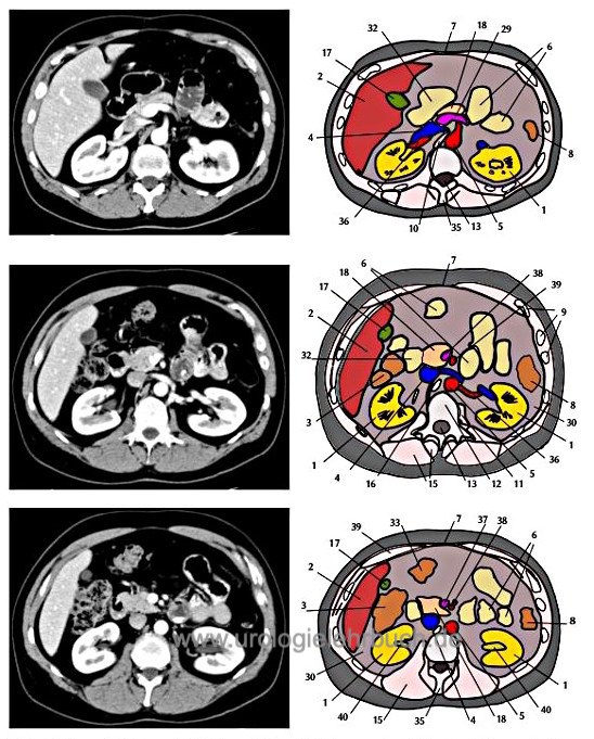 Abbildung CT Schnittbild Anatomie Abdomen Becken 2