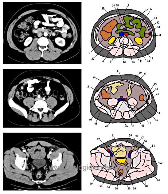Abbildung CT Schnittbild Anatomie Abdomen Becken 3