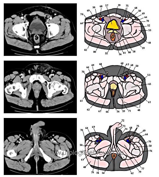 Abbildung CT Schnittbild Anatomie Abdomen Becken 4