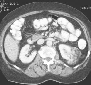 Urologisches Bilderrätsel Fall 2