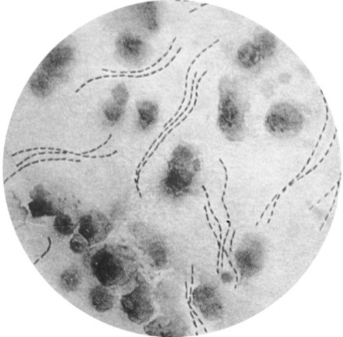 Mikroskopie Haemophilus ducreyi, Erreger des Ulcus molle