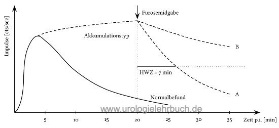 Abbildung Nierenszintigraphie schematischer Kurvenverlauf