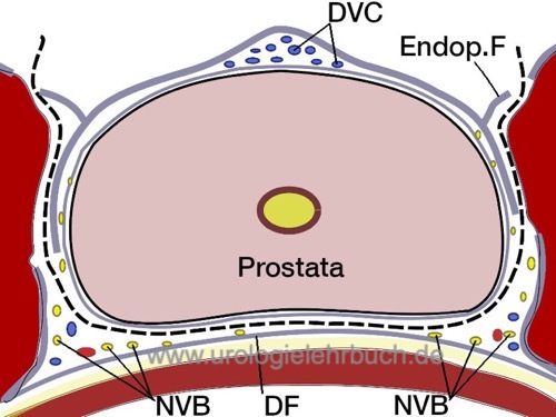 Abbildungen retropubische radikale Prostatektomie Anatomie der Nervenschonung Prostatafaszien