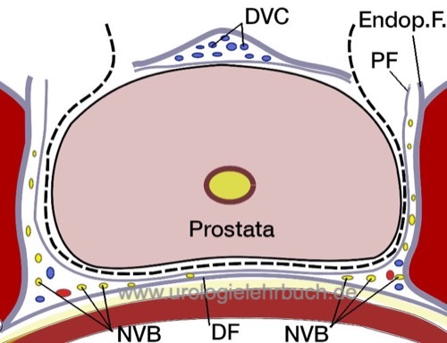 Abbildungen retropubische radikale Prostatektomie Anatomie der Nervenschonung Prostatafaszien