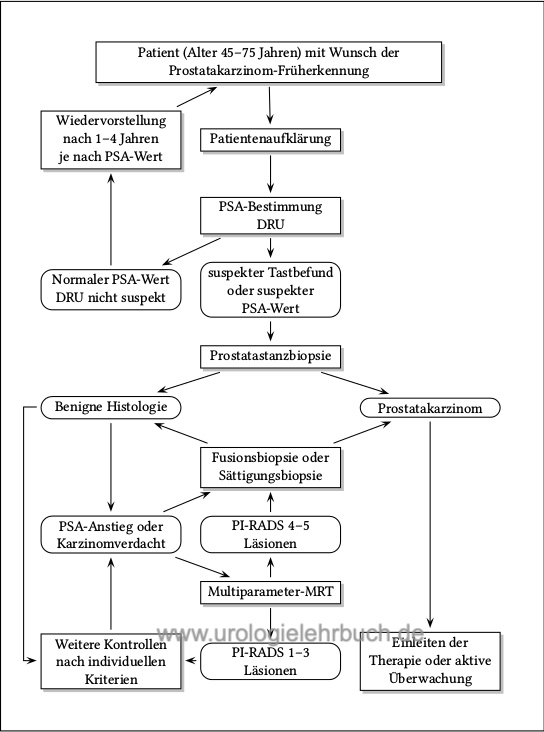 Flussdiagramm zur Früherkennung eines Prostatakarzinoms (PSA Screening)