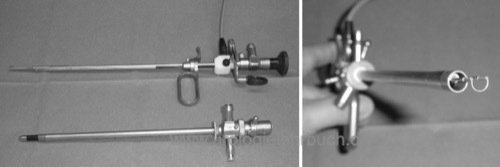 Abbildung Resektoskop: das Resektoskop besteht aus Arbeitseinsatz mit Elektroschlinge (Bild links oben) und Arbeitsschaft (Bild links unten). Mit Hilfe des Handgriffs kann die Elektroschlinge aus dem Arbeitsschaft bewegt werden (Bild rechts).