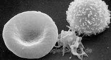 Sepsis beeinflusst die Blutzellen Blutzellen bei der Sepsis