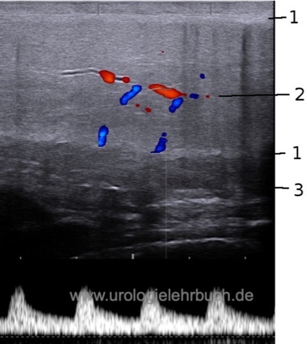 Abbildung Dopplersonographie des Penis