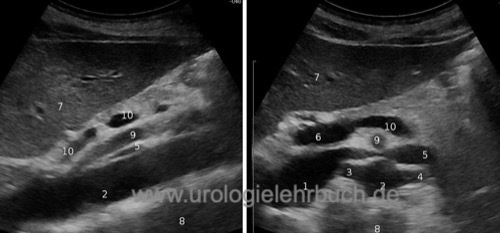 Sonographie Anatomie Ultraschall der retroperitonealen Gefäße